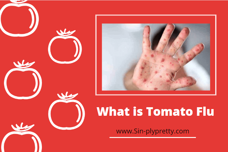 Tomato Flu – Facts and Prevention